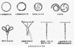 房山医院带环多少钱